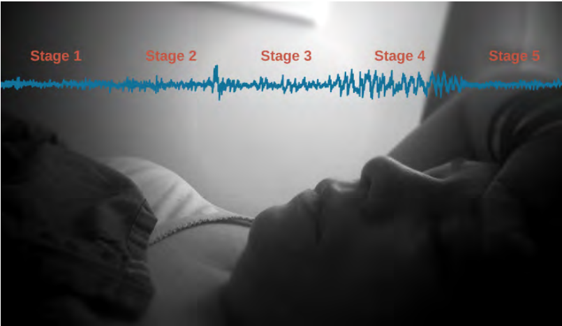 This is an image of a woman lying down, face up, with her eyes closed. Above her body there is a blue line symbolizing sleep waves. The line is labelled from left to right: Stage 1, Stage 2, Stage 3, Stage 4 and Stage 5.
