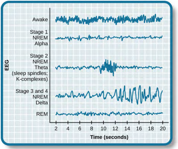 This chart shows brain activity over a period of 20 seconds during the various stages of sleep. The X axis is labelled with time in seconds. Along the Y axis are the sleep stages, listed as: Awake, Stage 1 NREM Alpha, Stage 2 NREM Theta, Stage 3 and 4 NREM Delta, and REM. There is one wave on the graph for each stage. The Awake wave is characterized by moderate amplitude and high frequency. Stage 1 shows less activity, with occasional spikes in amplitude, and a lower average frequency. Stage 2, characterized by spindles and K-complexes, has a spike in activity between 10 and 12 seconds, with higher amplitude and higher frequency, which comes and goes abruptly. The stage 3 and 4 wave has a moderate frequency throughout, with the amplitude slowly increasing over the 20 second period. Finally, REM has a moderate frequency, with some fluctuations, and a fairly low amplitude throughout.