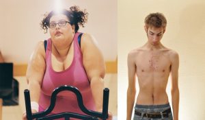 This image shows two separate pictures. The picture on the left is a photo of a young woman sitting on an exercise bike. She is overweight and wearing a pink tank top. She is wearing glasses and her dark, curly hair is styled in pigtails. The image on the right shows a young male standing in his jeans with no shirt on. He is very thin and looking down towards the floor.
