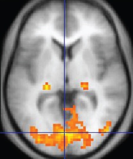 This is an image of a fMRI showing activation of the visual cortex in response to visual stimuli.